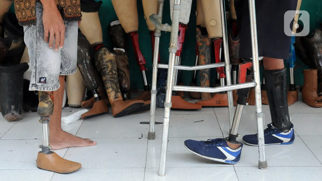 FOTO: Semangat Penyandang Disabilitas Pembuat Kaki Palsu