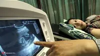 Apa Pentingnya Periksakan Kehamilan dengan USG?