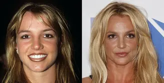 Britney Spears pernah mengaku pada Instyle bahwa dirinya melakukan lip injections. (Rex - Shutterstock - HollywoodLife)