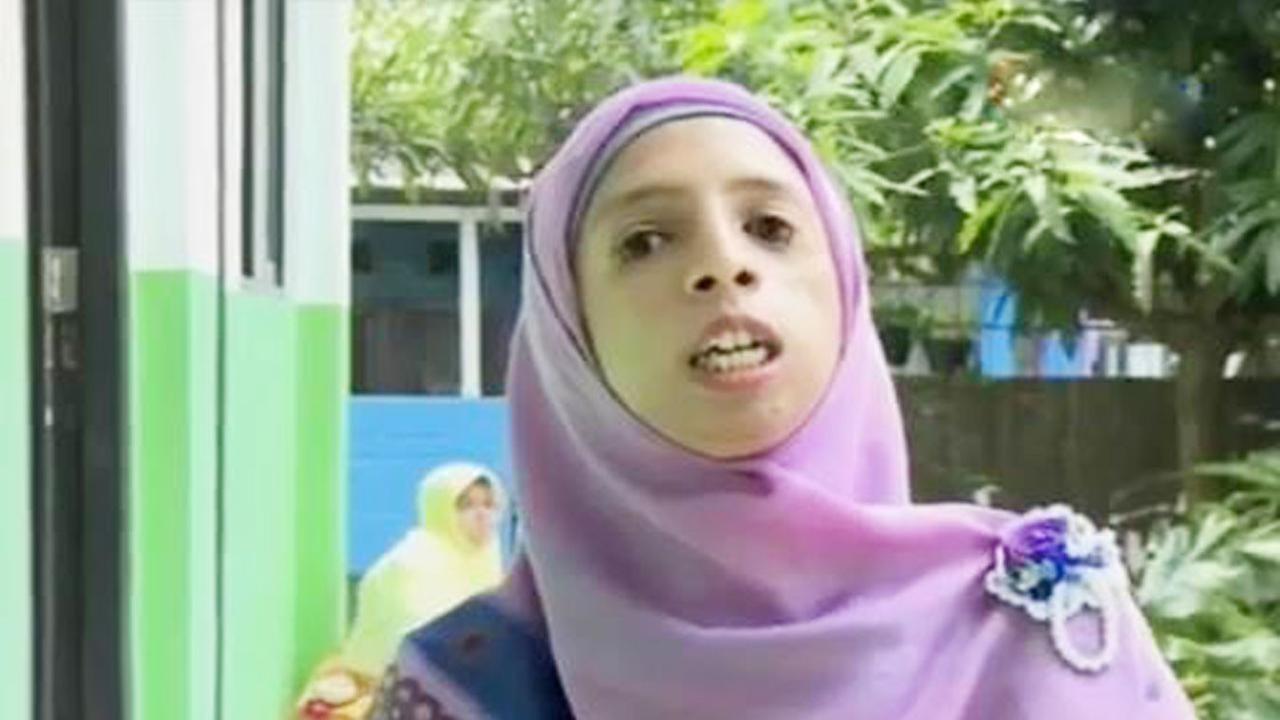 Kisah Semangat Lisa Guru Idap Penyakit Langka