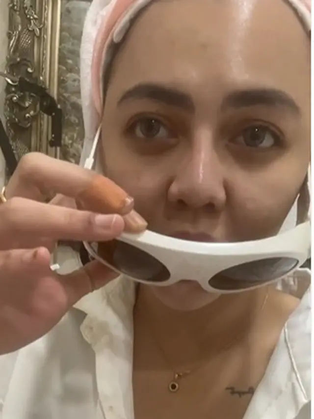 Demi Anak, Ini 6 Momen Ratu Rizky Nabila Hapus 13 Tatonya