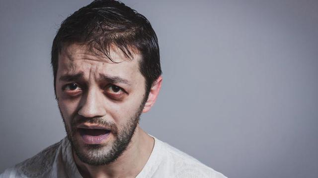 Wajah Pucat, Benarkah Selalu Karena Anemia?