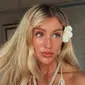 Turis asing yang merupakan beauty influencer bernama Charlene Morrissey dilaporkan kecelakaan di Bali. (dok. Instagram @___itsher/https://www.instagram.com/p/C5K3yYGLbS1/)