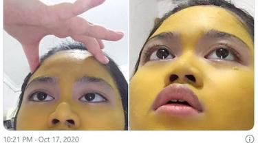 Top 3 Gadis Ini Pakai Kunyit Buat Masker Wajah Hasilnya Bikin Ngakak Citizen6 Liputan6 Com