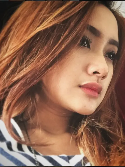 Bombom menambahkan jika Herdi sudah menderita komplikasi penyakit sekitar 2 bulan belakangan. Bahkan sempat diberitakan bahwa ayah Cita Citata itu harus dirawat di rumah sakit karena kondisi fisiknya yang menurun. (Via Instagram/@Cita_citata)