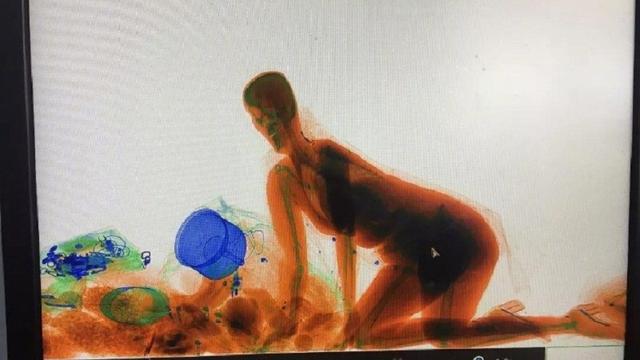 Kocak, Takut Tasnya Dicuri, Wanita Ini Masuk ke Mesin Sinar-X