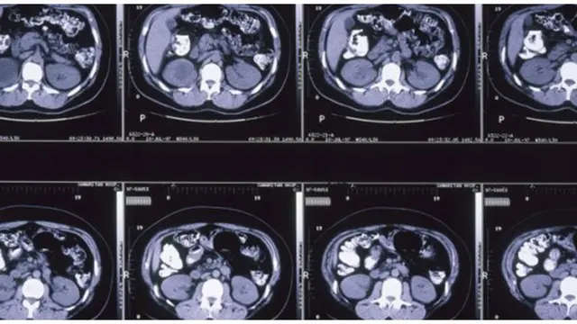 Foto : copyright listverse.com