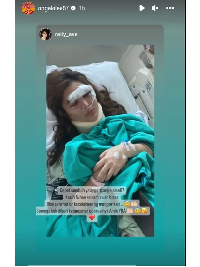 6 Potret Kondisi Angela Lee Pasca Alami Kecelakaan Mobil di Tol, Kaki Dipasang Pen