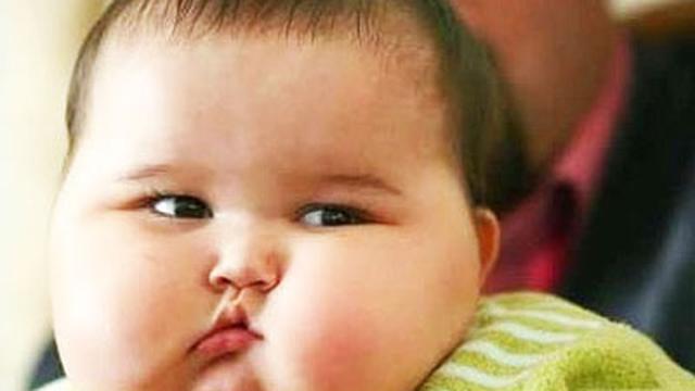 Dokter: Anak Terlihat Baik-Baik Saja Belum Tentu Bebas Obesitas