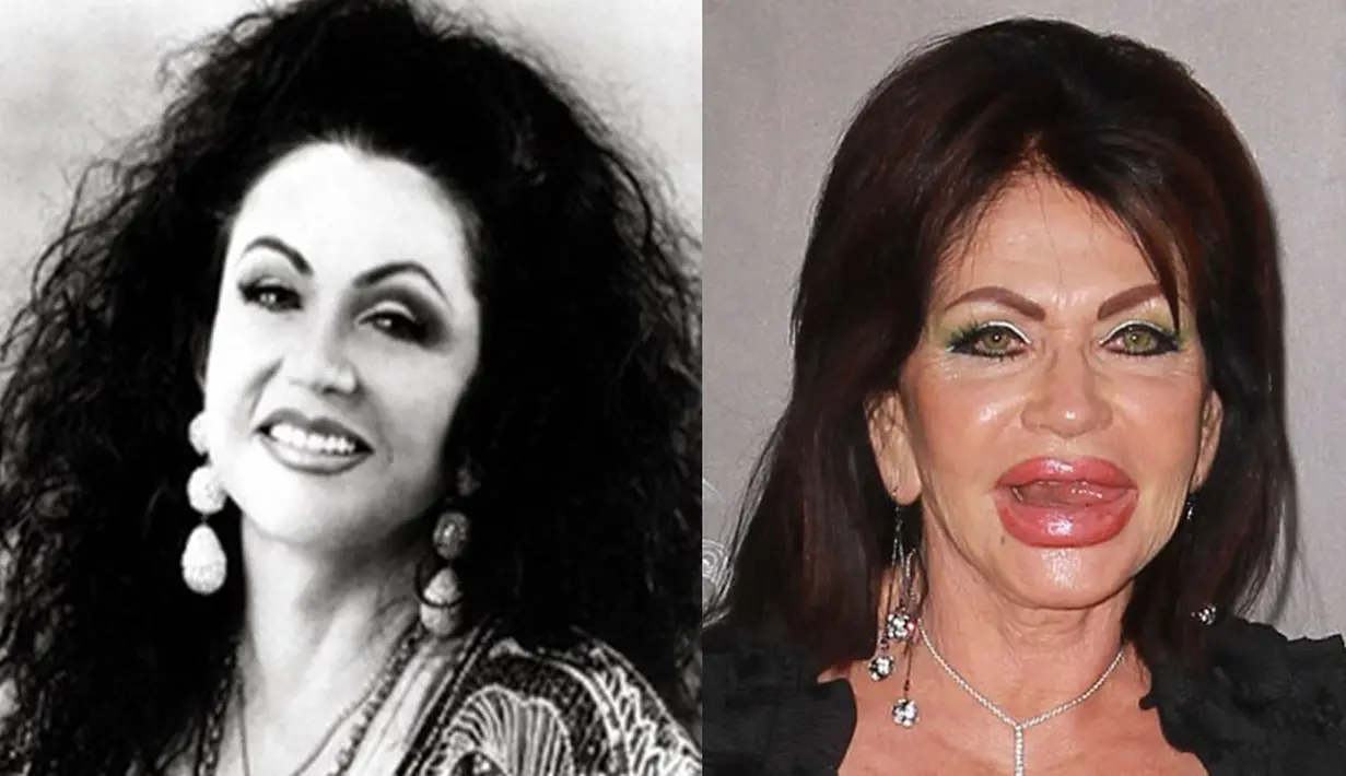 Khawatir terlihat tua membuat Jacky Stallone melakukan operasi plastik. Hasilnya, bibir Ibu dari Sylvester Stallone ini terlihat aneh (Istimewa)