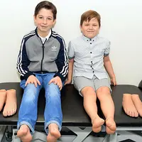 Kisah haru dari dua bocah yang lahir tanpa telapak kaki.