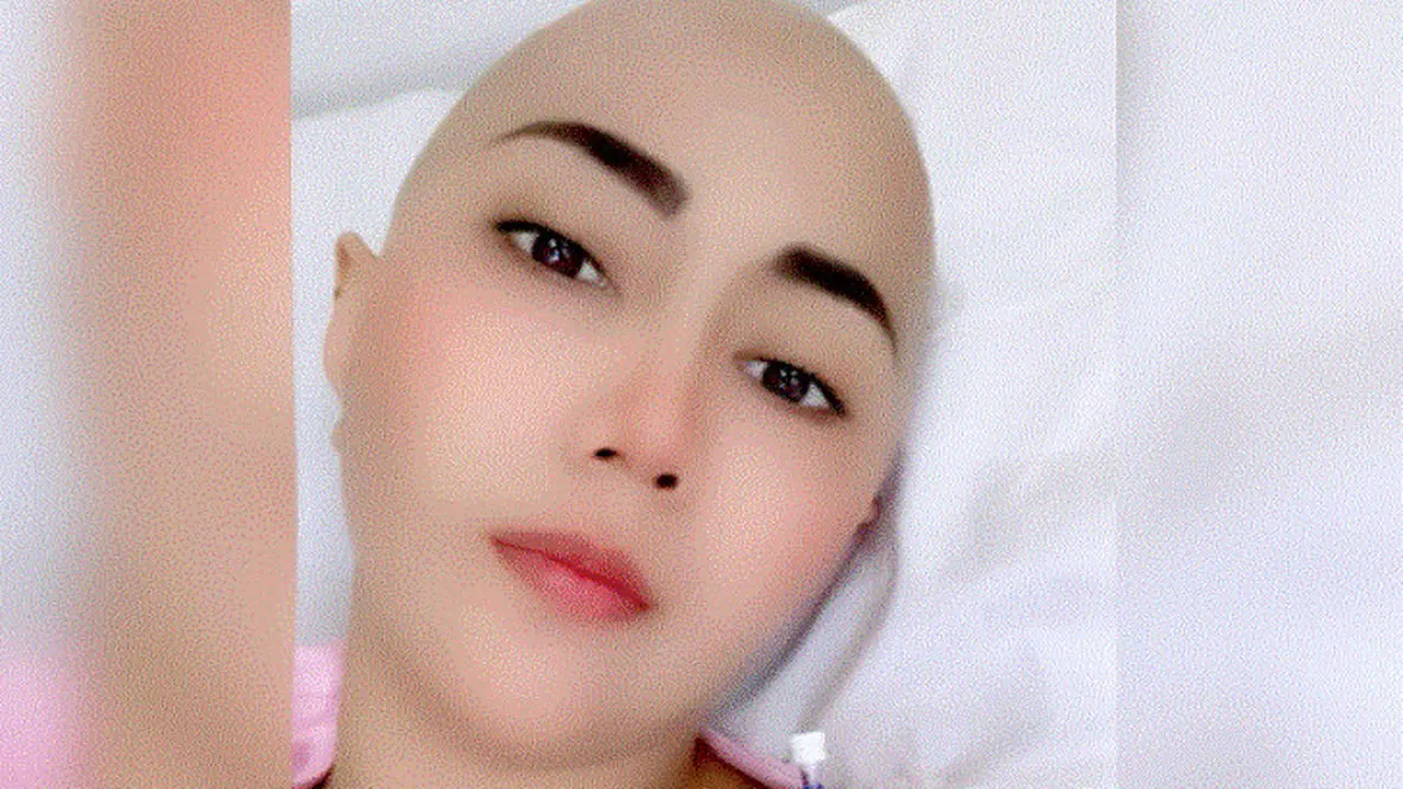 Aida Sakia jalani kemoterapi akibat kanker payudara