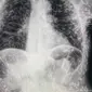 Sinar X-ray dari tubuh pria (Tangkapan layar dari website odditycentral.com)