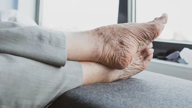 Penyebab Osteoporosis