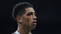 Darah mengalir di wajah gelandang Real Madrid, Jude Bellingham, setelah imengalami cedera dalam pertandingan Liga Spanyol melawan Celta Vigo di Stadion Santiago Bernabeu, Senin (8/12/2025) dini hari WIB. (Thomas Coex/ AFP)