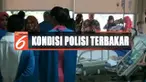 Kondisi Ipda Erwin sendiri masih belum bisa diajak berkomunikasi dan hanya berbaring di atas ranjang ruang perawatan.