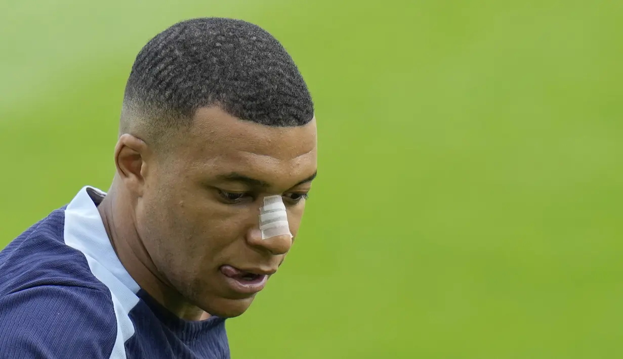 Tetapi, Federasi Sepak Bola Prancis optimis Mbappe  akan kembali tepat waktu untuk tampil di turnamen. (AP Photo/Hassan Ammar)