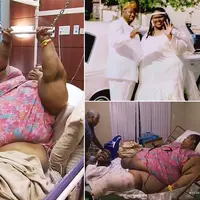 Berbobot lebih dari 300 kg, perempuan ini tak pernah bergerak selama 2 tahun. Saking beratnya, butuh 8 orang buat memindahkannya dari kasur.