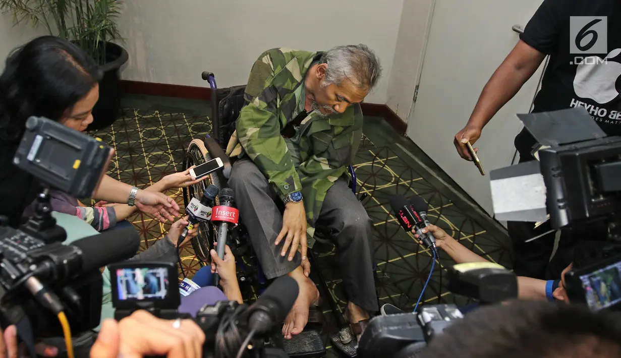 Aktor Tio Pakusadewo menunjukan bekas luka pasca kecelakaan di kawasan Kemang, Jakarta, Rabu (11/10). Tio Pakusadewo menceritakan tentang kecelakaan motor yang dialaminya pada beberapa bulan lalu. (Liputan6.com/Herman Zakharia)