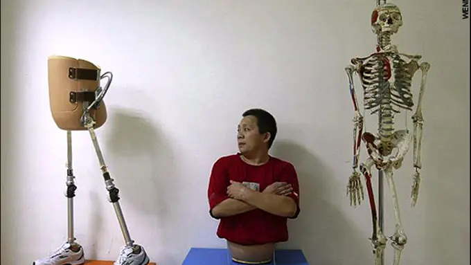 Peng Shuilin Pebisnis Sukses yang Kehilangan Setengah Tubuhnya