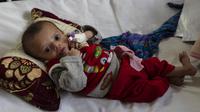 Seorang bayi laki-laki terbaring di tempat tidur saat menjalani perawatan di bangsal gizi buruk RS Anak Nasional Ataturk, Kabul, Afghanistan, 2 Desember 2021. Menurut PBB dari awal November, 8,7 juta orang di Afghanistan hidup mendekati kelaparan. (AP Photo/Petros Giannakouris)