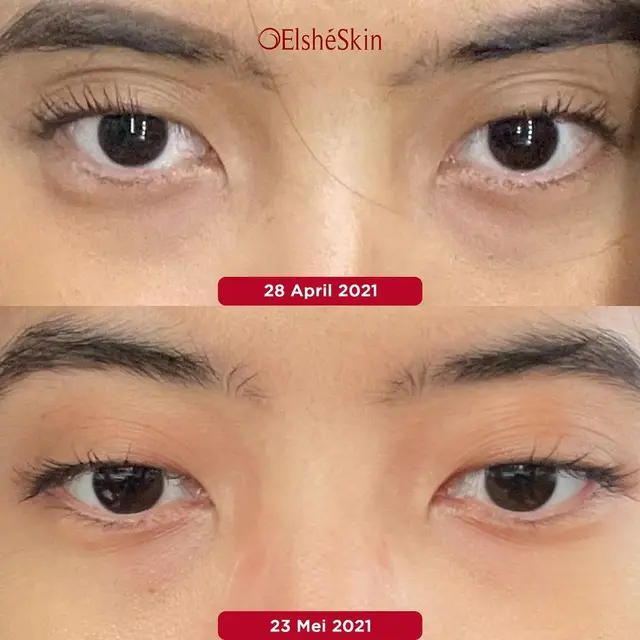 ElshéSkin Eye Serum Eyessential Night