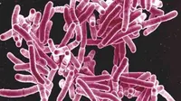 Foto kuman penyakit tuberkulosis, Mycobacterium tuberculosis (Foto:bpssoutheast.com)