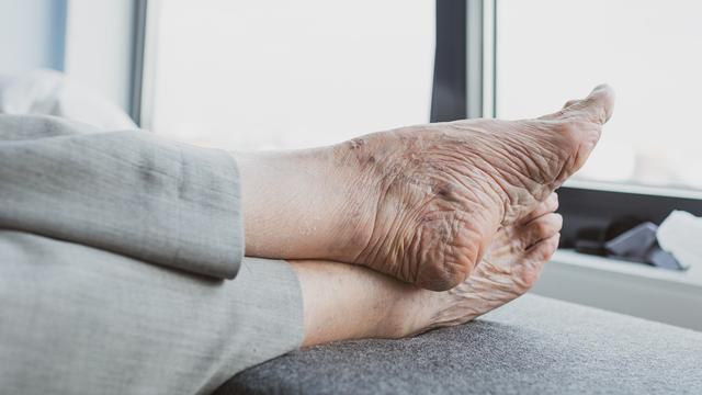 4 Cara Cegah Osteoporosis Sejak Dini, Salah Satunya Olahraga Teratur