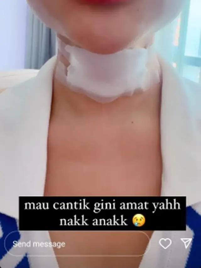6 Potret Hasil Operasi Potong Jakun Lucinta Luna, Belum Bisa Menelan