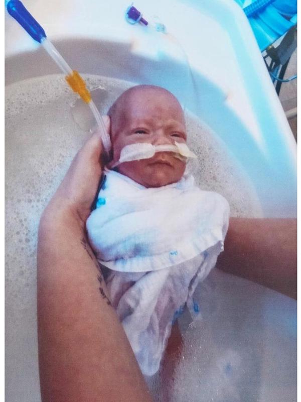 Berhasil Bertahan Bayi Seberat Minuman Kaleng Ini Kini Menggemaskan