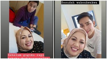 Ely Sugigi lakukan potong gigi