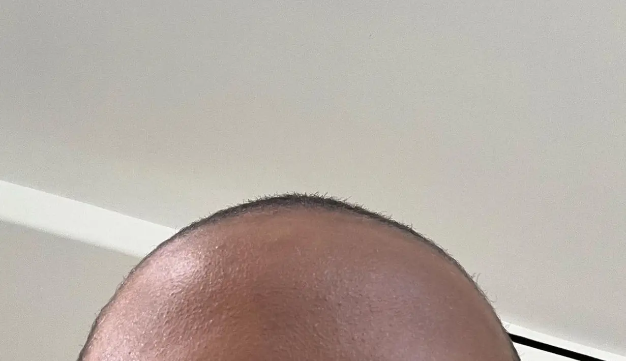Pemenang Grammy Awards itu bahwa keputusan memangkas rambut dan mencukur habis alisnya bukan karena dirinya depresi. (FOTO: instagram.com/dojacat)