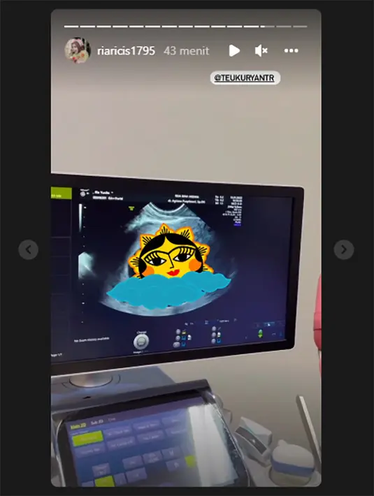 Ria Ricis dan Teuku Ryan (Instagram/riaricis1795)