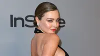 Supermodel, Miranda Kerr berpose untuk fotografer pada acara after party Golden Globes 2018 di Los Angeles, Minggu (7/1). Meski badannya mulai lebih berisi, namun mantan Angel Victoria's Secret itu masih terlihat cantik. (Joe Scarnici/GETTY IMAGES/AFP)