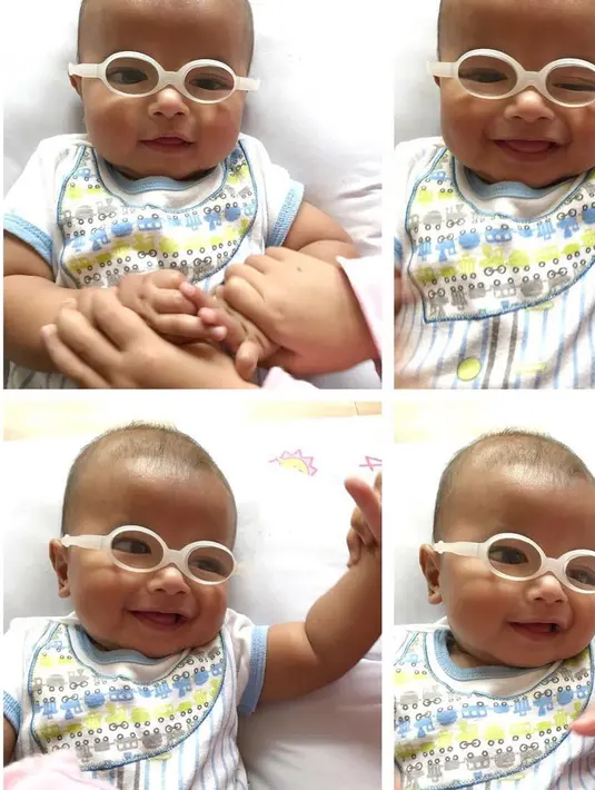 Perkembangan sang buah hati juga tak luput dari perhatian para dokter yang menanganinya. Dokter juga belum menemukan kelainan lain yang terjadi pada anak kedua Asri. (Instagram/asri_welas)