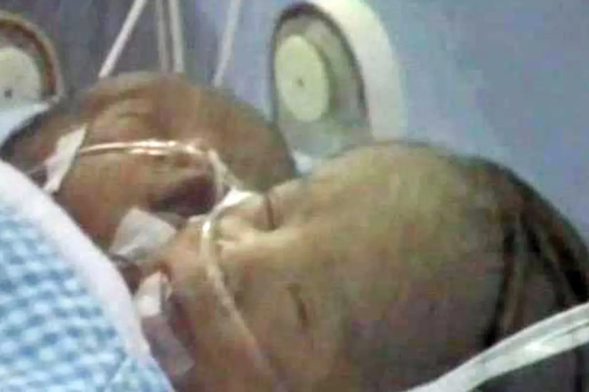BAYI KEPALA 2