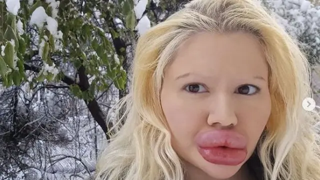 6 Foto Terkini Andrea Ivanova Wanita Viral Bibir Terbesar, Kini Rambutnya Pirang