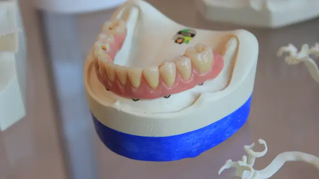 Lidah buaya sebagai kesehatan mulut