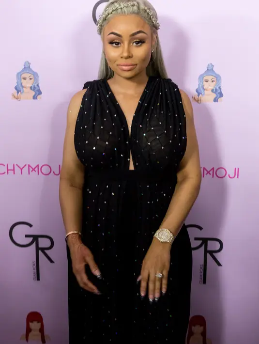 Rob dan Blac nampaknya tak perduli dengan kritikan tajam dari haters. Kali ini, Blac dan Rob sangat bahagia melihat perkembangan buah hatinya lewat USG. (AFP/Bintang.com)