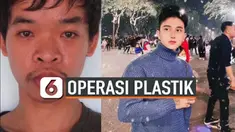 OPERASI PLASTIK