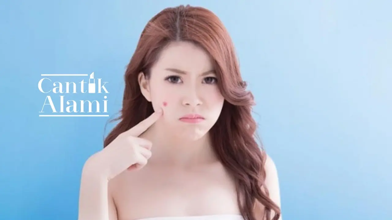 Cantik Alami: Bekas Jerawat Bikin Nggak Pede? ini Dia Solusinya