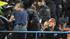 An injured Marseille supporter holds up his hands after clashing with riot police prior to the start of a Champions League football match against Atletico de Madrid at the Vicente Calderon stadium in Madrid on October 01, 2008. AFP PHOTO/PHILIPPE DESMAZES