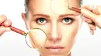 Kanker melanoma adalah jenis kanker kulit yang menyerang sel melanosit. Berikut gejala kanker melanoma yang harus diwaspadai.