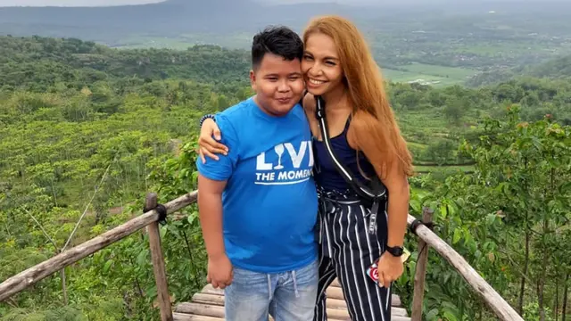 16 Tahun Berlalu, Ini 6 Potret Terbaru Icha AFI yang Kini Jadi Dokter Gigi