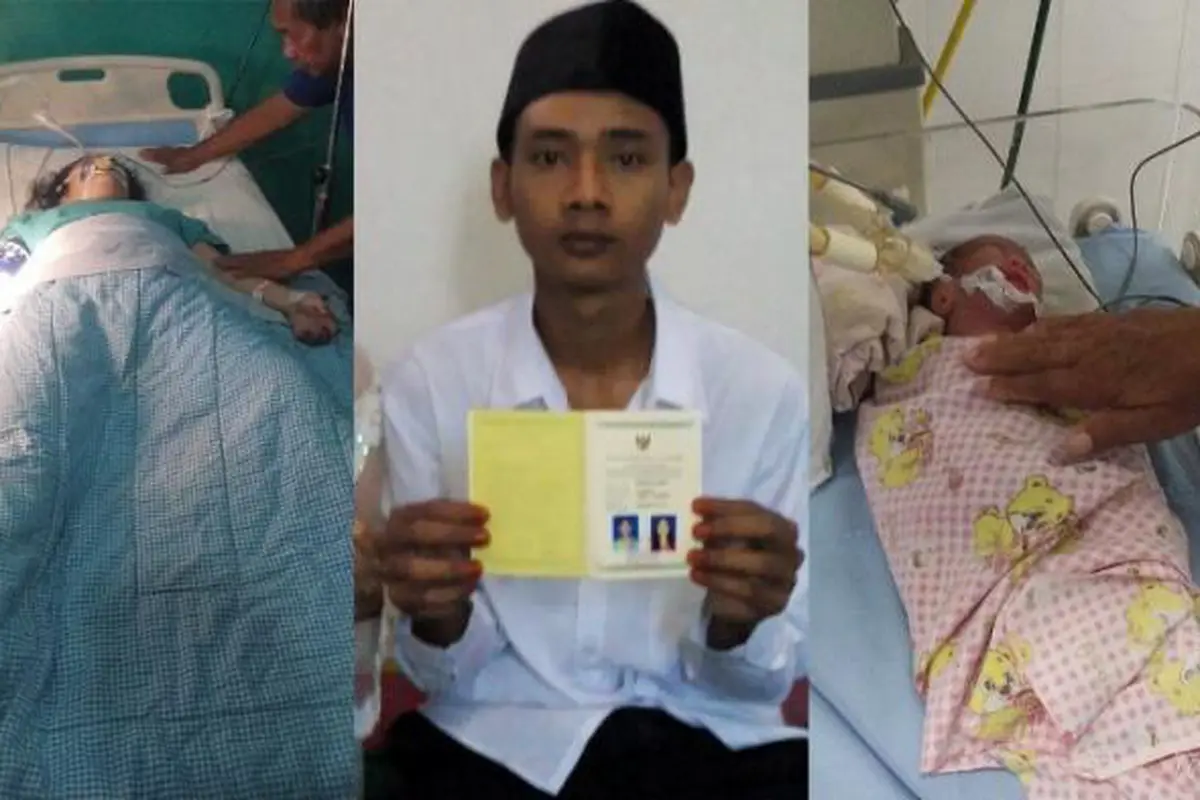 Wanita di Medan Meninggal Gara-gara Pakai Krim Pemutih Wajah
