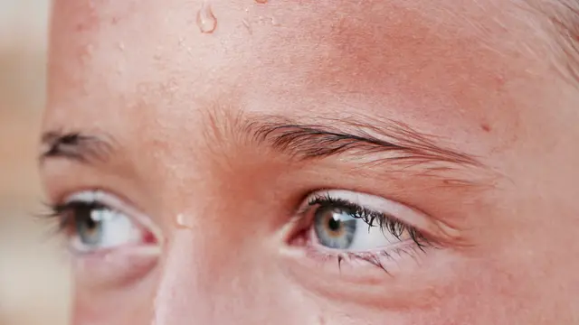 Hiperhidrosis Fokal Primer dan Sekunder