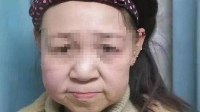 Xiao Feng, remaja yang memiliki wajah seperti lansia (Tangkapan Layar Mirror)