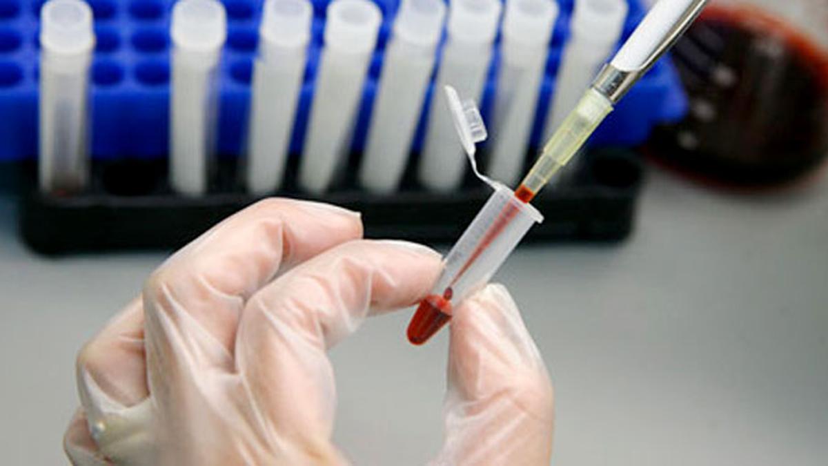 Jika Hasil Tes HIV Pertama Negatif, Coba Periksa Tiga Bulan Lagi