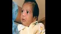 15-11-1984: Akhir Hayat Bayi Transplantasi Jantung Babon