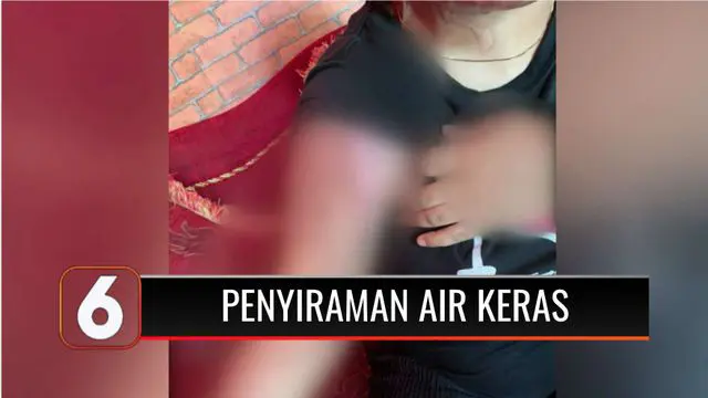 Terbakar api cemburu, seorang sopir truk di Lampung Tengah, Lampung, ditangkap polisi karena menyiram istri dan anaknya dengan air keras. Kedua korban mengalami cacat permanen akibat perbuatan tersangka.